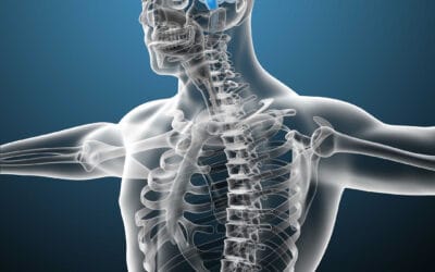 Chiropractic and Arnold Chiari Malformation