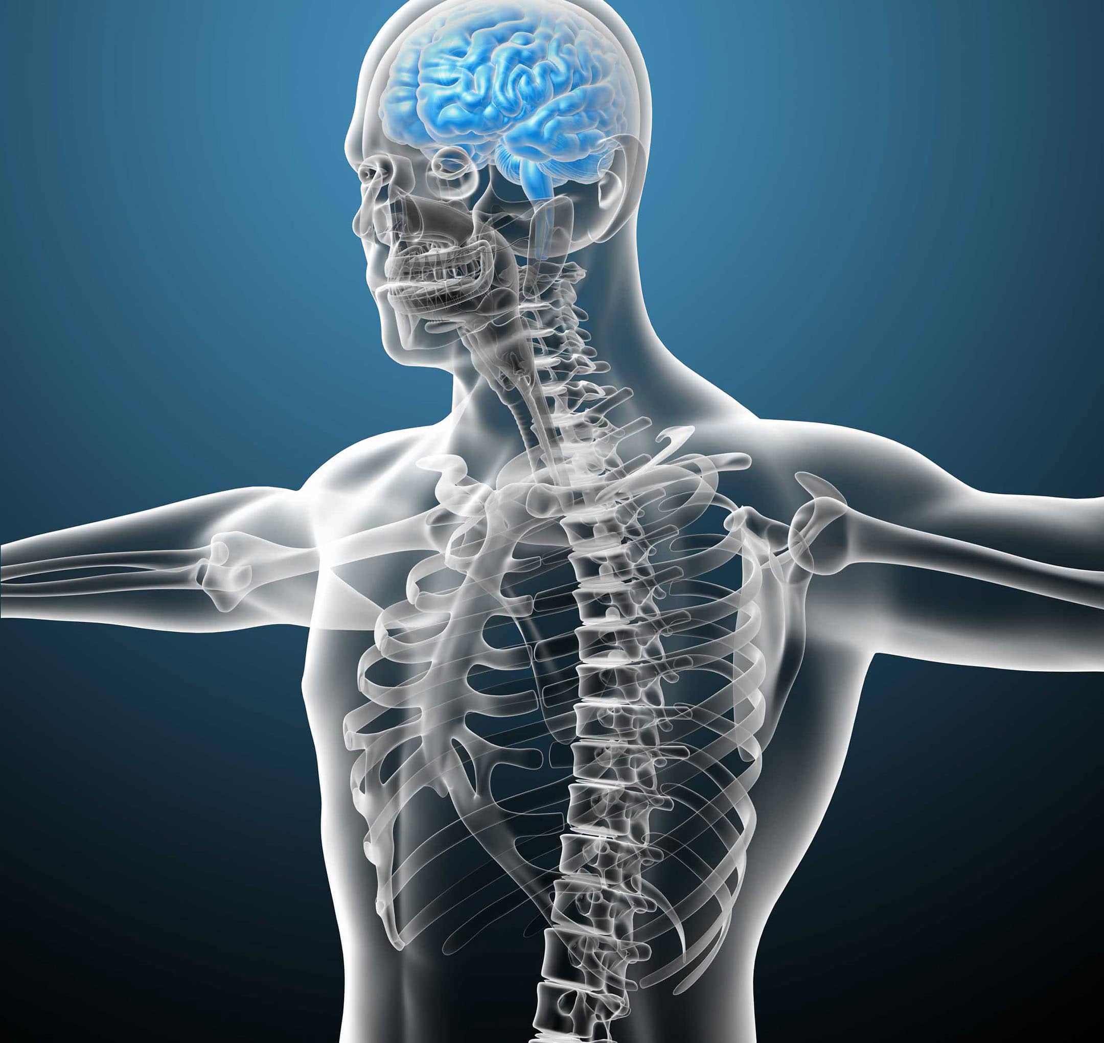 Chiropractic and Arnold Chiari Malformation - Innovative Nerve & Joint ...